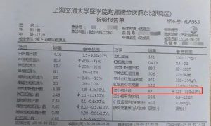 上海22岁小伙头痛咳嗽，忽冷忽热！一年前曾出国游玩，医生：这种病严重可致命缩略图