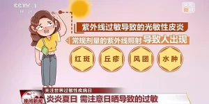 皮肤红肿、瘙痒？你可能“对太阳过敏”！防护指南快查收缩略图